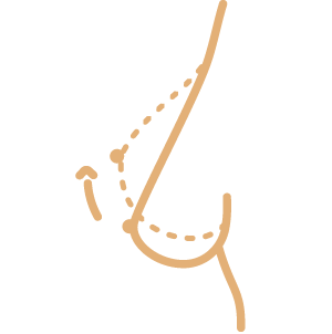 Endoscopia E Descompressão Tubular